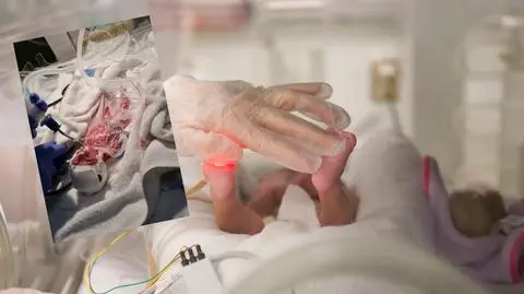 Noworodek w torebce śniadaniowej