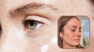 Minimalistyczny makijaż na lato. Ten trend robi furorę na TikToku 