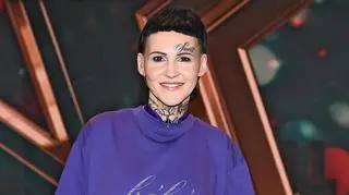 Agnieszka Chylińska zdecyduje się na kolejną metamorfozę? Ekspert: "Zmiany mogą być nieodwracalne"