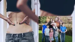 Wygrała z anoreksją i urodziła 9 dzieci. "To cud, że moje ciało wróciło do normy"