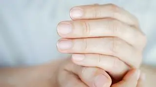 Co wygląd paznokci, mówi o naszym zdrowiu? Specjalistka podpowiada, na co zwrócić uwagę 