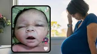 Lekarze byli pewni, że dziecko urodzi się martwe. Na porodówce doszło do cudu