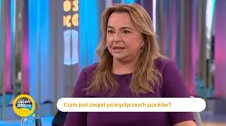Co 10 kobieta zmaga się z PCOS. Jakie są objawy choroby?