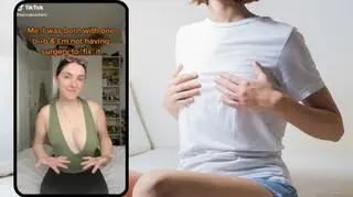 Ma dwie nierówne piersi. Lekarze nie słyszeli o jej chorobie