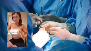 Piersi w rozmiarze 34E zniszczyły jej kręgosłup. Po porodzie zdecydowała się na radykalny krok