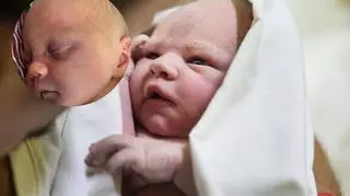 Te noworodki wyglądają jakby brały udział w bójce. Położna wyjaśnia, skąd otarcia i siniaki na ich buziach