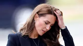 Tajemnicza blizna na głowie Kate Middleton. Czy to dlatego księżna wyjechała z Londynu?