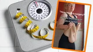 Kobieta schudła 82 kg. "Mówią, że mogłabym użyć skóry jako spadochronu"