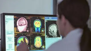 Spędzasz wolny czas przed telewizorem? Skutki mogą być dramatyczne  