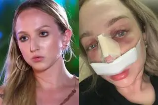 Kornelia w programie "Hotel Paradise" i tuż po operacji