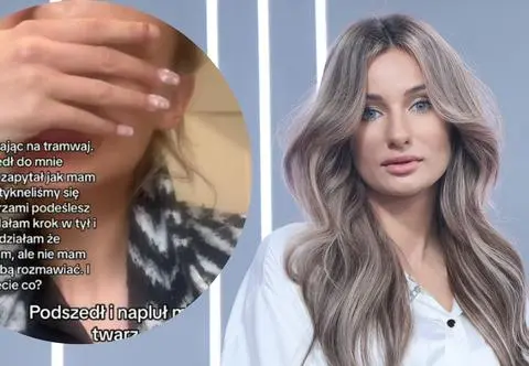 Uczestniczka "Top Model" zaatakowana na ulicy. Prawnik tłumaczy, co robić w takiej sytuacji 