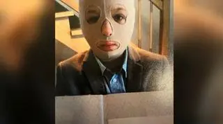 Ciało Alana było poparzone w 70 proc. Chłopiec żyje dzięki opatrunkom ze skóry ojca