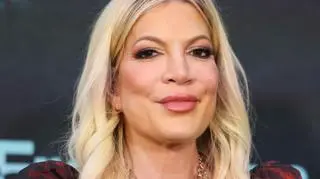 Tori Spelling urodziła 5 dzieci. Podczas jednej z wizyt ginekolog skomentował jej narządy intymne
