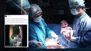 Dramatyczne nagranie z cesarskiego cięcia przy świetle latarki. Lekarz nieomal uciął ucho noworodka