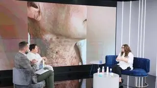 Zdjęcie szyi stało się viralem w sieci. Ekspertka przestrzega: "Twarz powinna kończyć się na dekolcie"