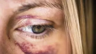 Co trzecia kobieta na świecie doświadczyła przemocy fizycznej lub seksualnej: "Fakty są szokujące"