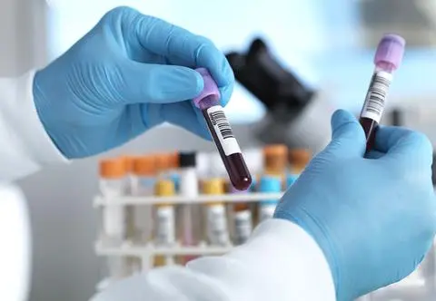 Proste badanie może wykryć ryzyko rozwoju Alzheimera. Wystarczy sprawdzić dwa parametry 