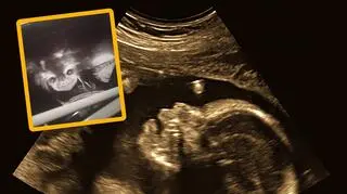 Okrzyknięto ją "diabelskim dzieckiem". Jak wygląda dzisiaj?