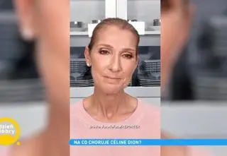Choroba Céline Dion wciąż postępuje. Na czym polega? "Rozwija się około 40 roku życia"