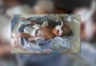 Ignaś to jeden z najmłodszych wcześniaków w Polsce