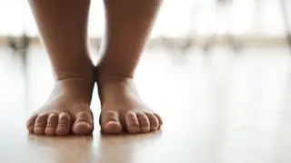 Haluksy mogą pojawić się także u dzieci. "Młodzi ludzie z płaskostopiem są bardziej podatni na zniekształcenia"