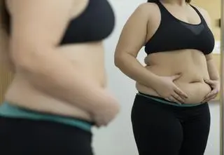 Schudła 90 kg i zgłosiła się na operację usuwania nadmiaru skóry. Chirurg nie podołał wyzwaniu