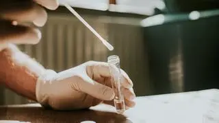 Omikron – nowy, wysoce zaraźliwy wariant koronawirusa. Minister Niedzielski wydał polecenie sanepidowi