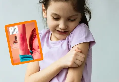 Dziewczynka myślała, że uwiera ją metka. Niedługo później zrobiła się blada i zaczęła drżeć