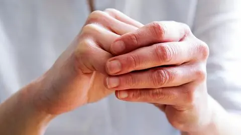 Paznokcie Terry'ego - czym się charakteryzują, o jakich chorobach świadczą?