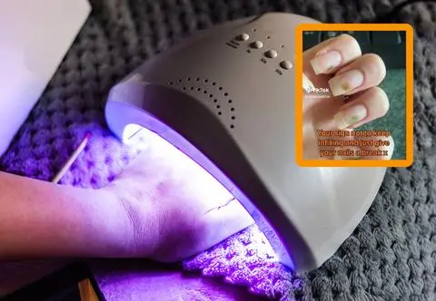 Kobieta nabawiła się grzybicy przez źle zrobiony manicure. 