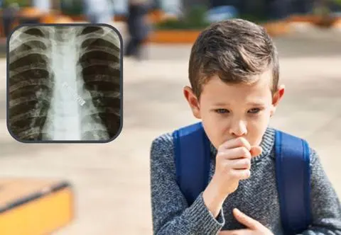Miesiącami ignorowali kaszel 5-letniego synka. Przyczyna jego dolegliwości zszokowała lekarzy