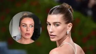 Czesała się jak Hailey Bieber, aż zaczęły wypadać jej włosy. Teraz ostrzega inne dziewczyny