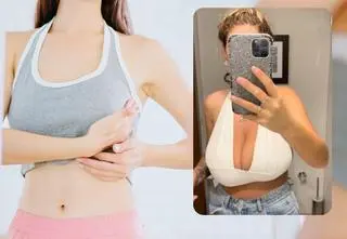 Gigantyczny biust od lat rujnował jej życie. W końcu zdecydowała się na operację. "Moje piersi sięgały brzucha"