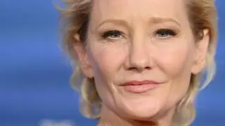 Hollywoodzka aktorka poważnie ranna w wypadku