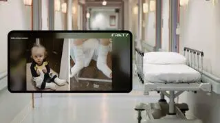 Alanek już drugiego dnia życia miał nogi w gipsie