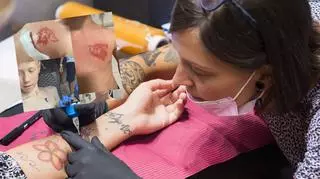 Tatuaż z henny może być niebezpieczny? Nastolatek będzie miał blizny do końca życia