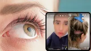 Brytyjka przeszczepiła brwi w Polsce - efekty