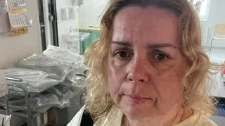 "Dopiero w łazience zobaczyłam, jak zwisa mi skóra"