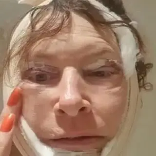 Operacja 54-letniej Shirley