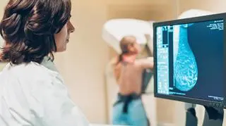 Dlaczego Polki nie chodzą na badania? "Są miejsca, w których raka piersi postrzega się jako dowód zdrady męża przez żonę"