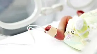 Noworodek "w ciąży". To bardzo rzadka anomalia medyczna