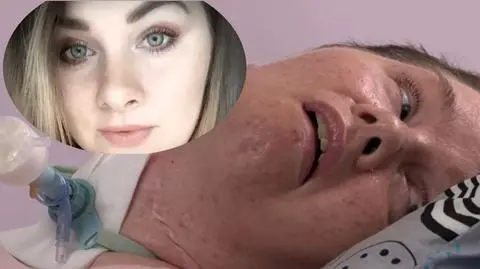 Uwaga TVN. Mąż poderżnął żonie gardło. Kobieta jest przykuta do łóżka