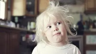 Była szykanowana z powodu włosów, zrobiła z nich atut