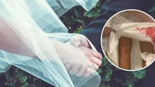 Podczas wesela odkryła, że jej suknia ślubna jest cała we krwi. "Myślałyśmy, że dostałam miesiączki"
