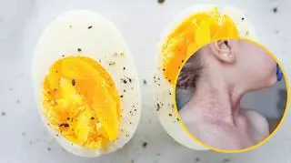 Alergia na białko jaja kurzego przestanie być problemem? Badacze dokonali ciekawego odkrycia