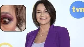 Ewa Drzyzga strój na Halloween
