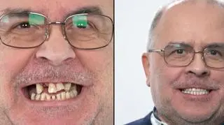 Zrobił niespodziankę żonie i przeszedł niesamowitą metamorfozę uśmiechu. Jak zareagowała?
