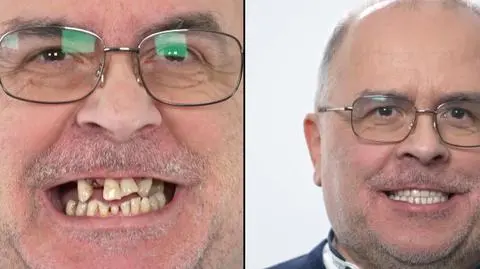 "Metamorfoza uśmiechu" Janusz Iskra
