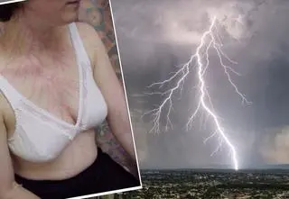 Wygląda fascynująco, ale świadczy o dramatycznym doświadczeniu. Czym jest figura Lichtenberga?