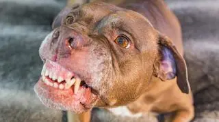 Pitbulle dotkliwie pogryzły 26-latkę. W ciężkim stanie trafiła do szpitala